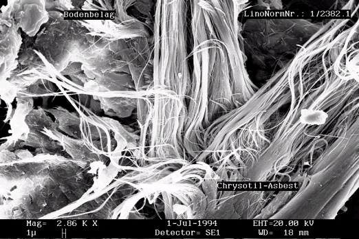 geändertes Format von Asbestfasern in Bodenbelag – 3000fach vergrößert